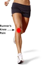 runner knee